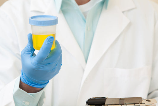 Can your workplace drug test you? Image of drug test being held my staff
