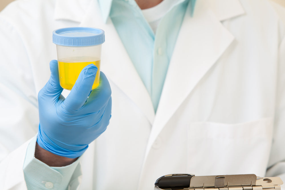 Can your workplace drug test you? Image of drug test being held my staff
